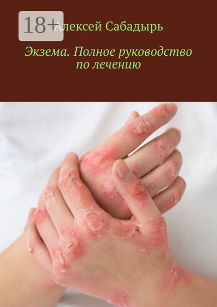 Обложка книги  «Экзема. Полное руководство по лечению»