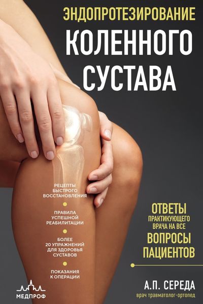 Обложка книги «Эндопротезирование коленного сустава. Ответы практикующего врача на все вопросы пациентов»