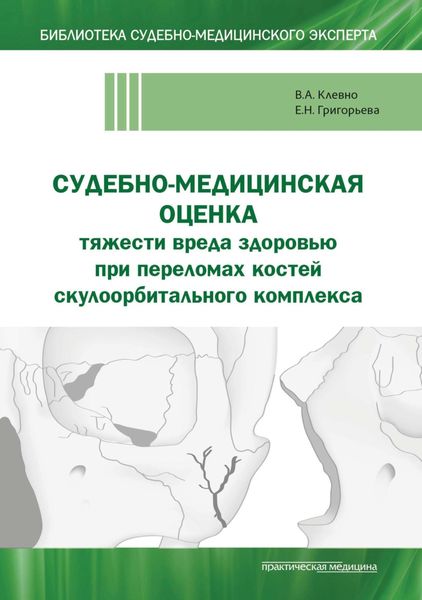 Обложка книги  «Судебно-медицинская оценка тяжести вреда здоровью при переломах костей скулоорбитального комплекса»