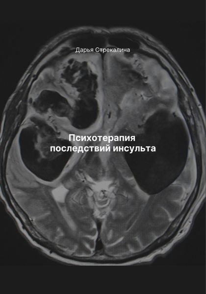 Обложка книги  «Психотерапия последствий инсульта»