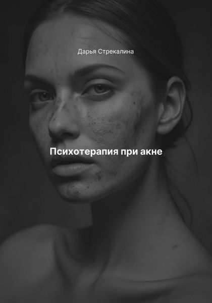 Обложка книги  «Психотерапия при акне»