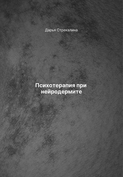 Обложка книги  «Психотерапия при нейродермите»