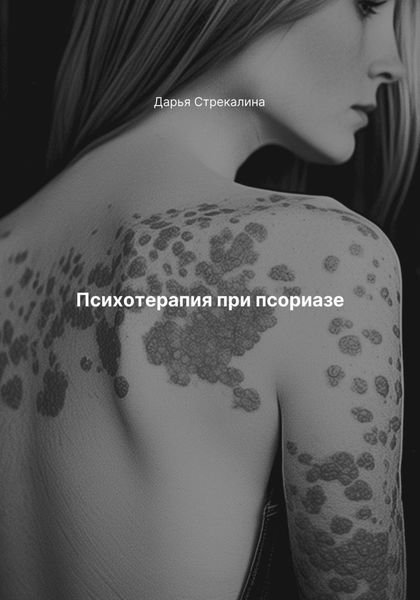 Обложка книги  «Психотерапия при псориазе»
