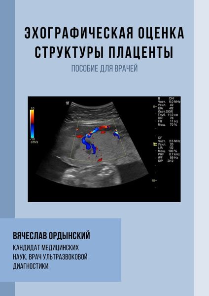 Обложка книги  «Эхографическая оценка структуры плаценты»