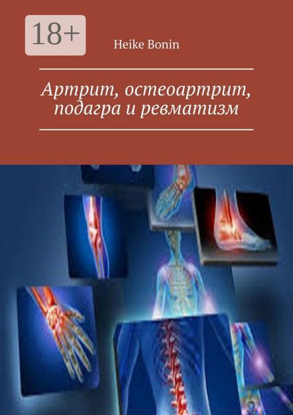 Обложка книги «Артрит, остеоартрит, подагра и ревматизм»