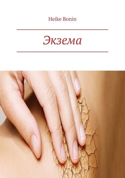 Обложка книги  «Экзема»