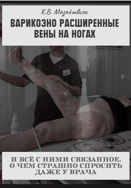 Обложка книги  «Варикозно расширенные вены на ногах и всё с ними связанное, о чём страшно спросить даже у врача»