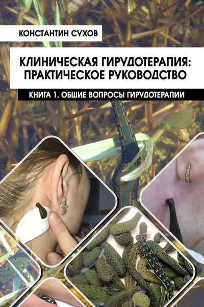 Обложка книги  «Клиническая гирудотерапия: практическое руководство. Книга 1. Общие вопросы гирудотерапии»