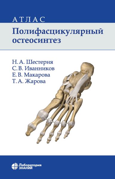 Обложка книги  «Полифасцикулярный остеосинтез. Атлас»