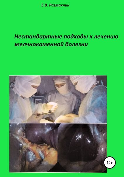 Обложка книги  «Нестандартные подходы к лечению желчнокаменной болезни»