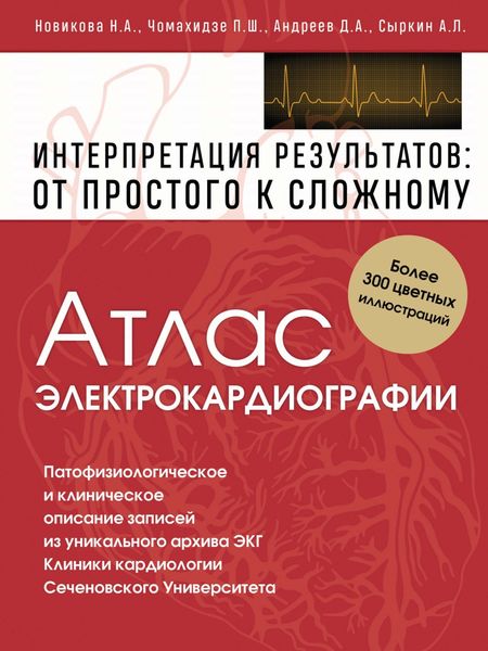 Обложка книги  «Атлас электрокардиографии. Интерпретация результатов: от простого к сложному»
