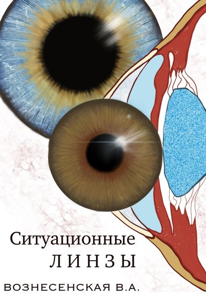 Обложка книги  «Ситуационные линзы»