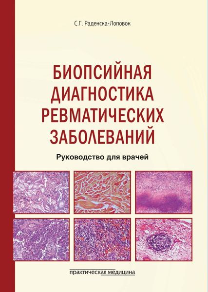 Обложка книги  «Биопсийная диагностика ревматических заболеваний. Руководство для врачей»