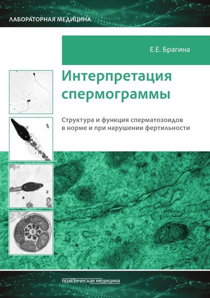Обложка книги  «Интерпретация спермограммы. Структура и функция сперматозоидов в норме и при нарушении фертильности»