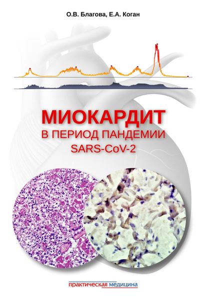 Обложка книги  «Миокардит в период пандемии SARS-CoV-2»