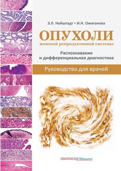 Обложка книги  «Опухоли женской репродуктивной системы. Распознавание и дифференциальная диагностика. Руководство для врачей»