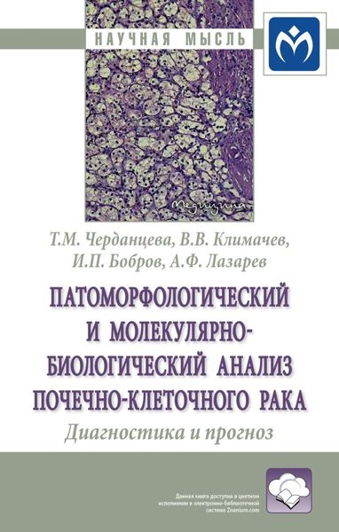Обложка книги  «Патоморфологический и молекулярно-биологический анализ почечно-клеточного рака. Диагностика и прогноз»