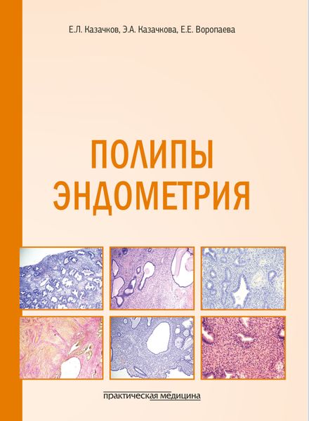 Обложка книги  «Полипы эндометрия. Учебное пособие»