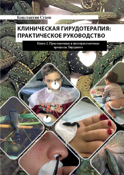 Обложка книги  «Клиническая гирудотерапия: практическое руководство. Книга 2 Приставочные и постприставочные процессы. Гирудиноз»
