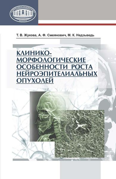 Обложка книги  «Клинико-морфологические особенности роста нейроэпителиальных опухолей»