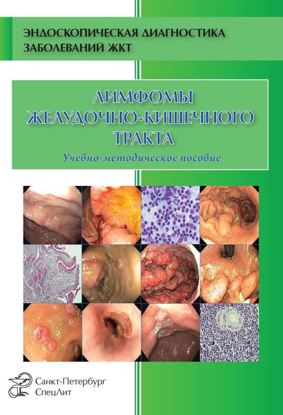 Обложка книги  «Лимфомы желудочно-кишечного тракта»