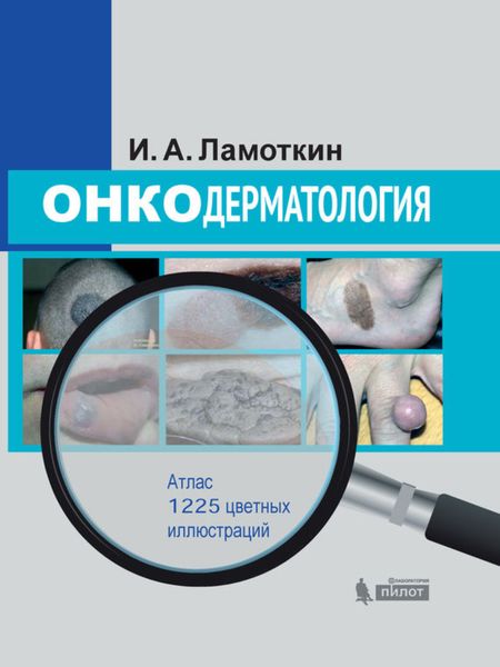 Обложка книги  «Онкодерматология. Атлас»