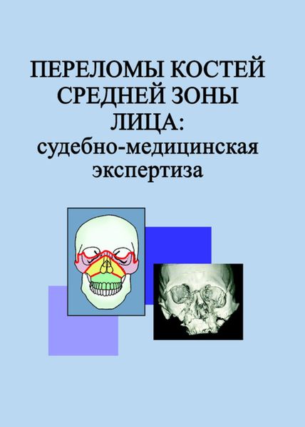 Обложка книги  «Переломы костей средней зоны лица: судебно-медицинская экспертиза»