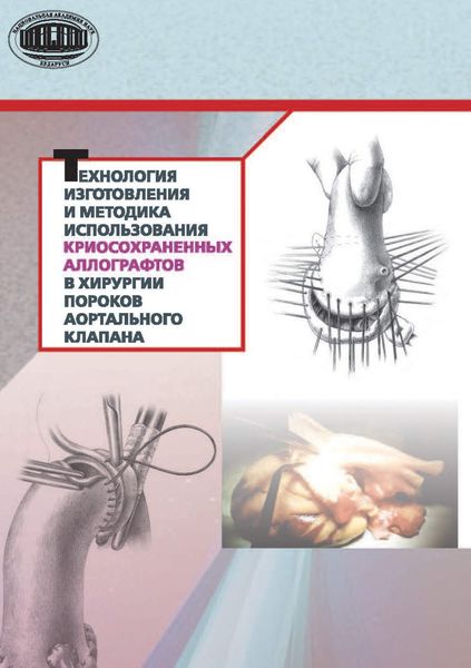 Обложка книги  «Технология изготовления и методика использования криосохраненных аллографтов в хирургии пороков аортального клапана»