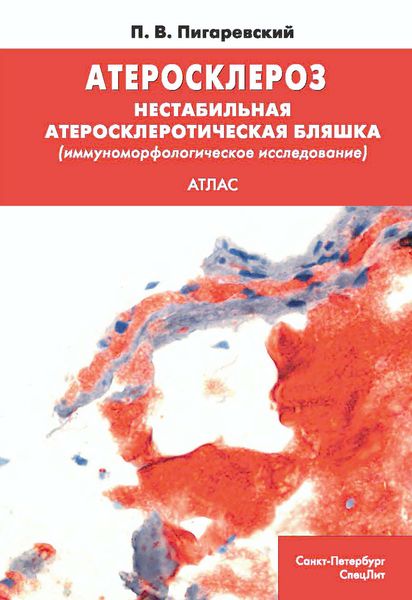 Обложка книги  «Атеросклероз. Нестабильная атеросклеротическая бляшка (иммуноморфологическое исследование)»