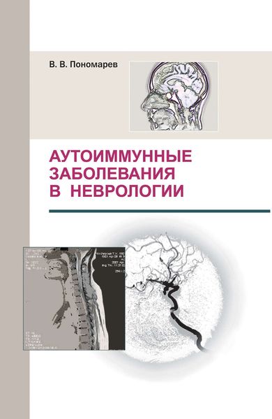 Обложка книги  «Аутоиммунные заболевания в неврологии»