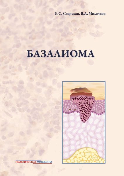 Обложка книги  «Базалиома»