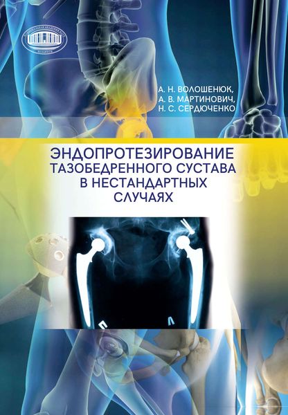 Обложка книги  «Эндопротезирование тазобедренного сустава в нестандартных случаях»