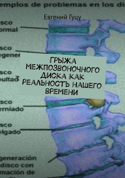 Обложка книги  «Грыжа межпозвоночного диска как реальность нашего времени»