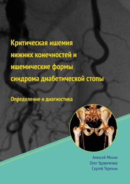 Обложка книги  «Критическая ишемия нижних конечностей и ишемические формы синдрома диабетической стопы»