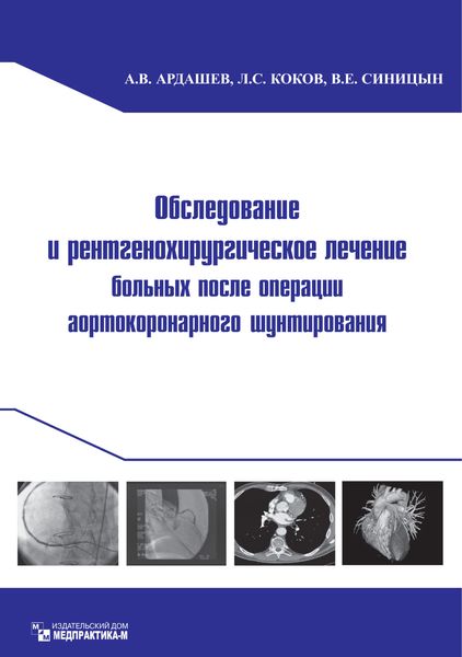 Обложка книги  «Обследование и рентгенохирургическое лечение больных после операции аортокоронарного шунтирования»