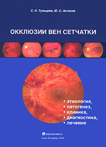 Обложка книги  «Окклюзии вен сетчатки (этиология, патогенез, клиника, диагностика, лечение)»