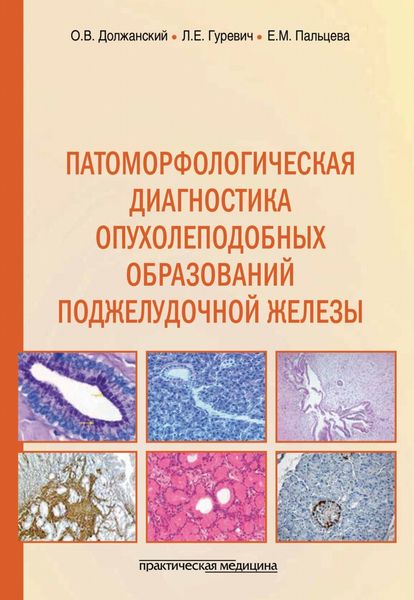 Обложка книги  «Патоморфологическая диагностика опухолеподобных образований поджелудочной железы. Руководство для врачей»