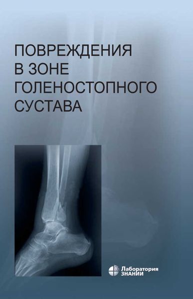 Обложка книги  «Повреждения в зоне голеностопного сустава. Атлас»