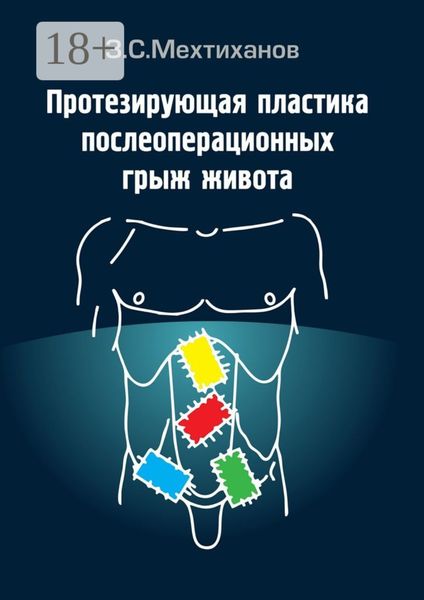 Обложка книги  «Протезирующая пластика послеоперационных грыж живота»