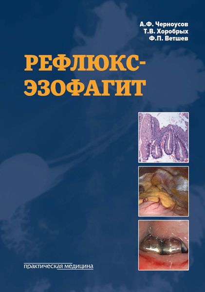 Обложка книги «Рефлюкс-эзофагит»