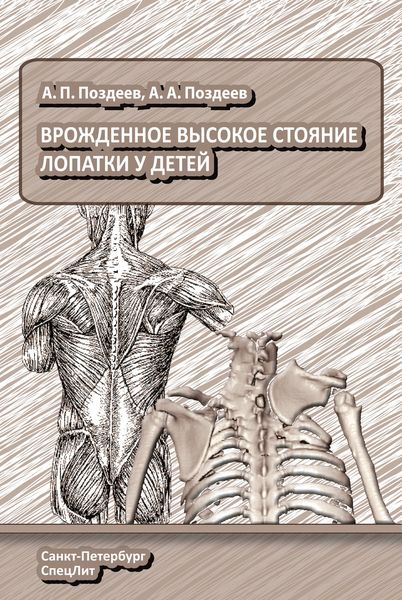 Обложка книги  «Врожденное высокое стояние лопатки у детей»